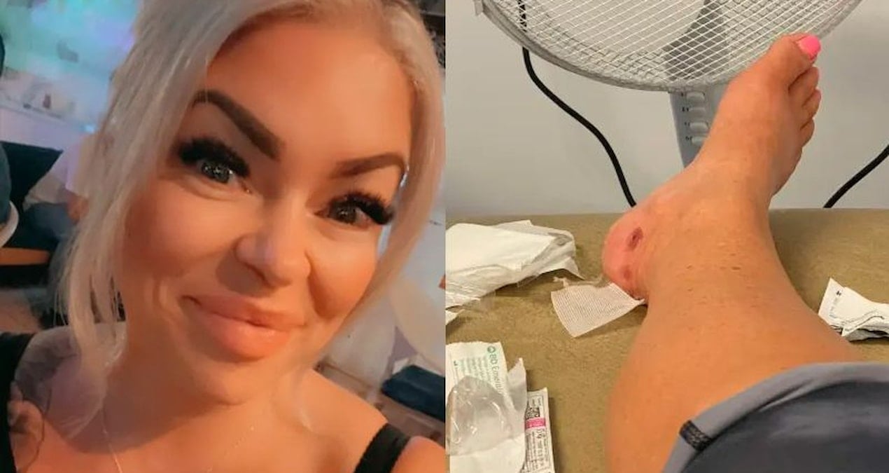 ingiliz kadinin bodrumdaki luks otelde yaptigi tatil ulkesine donunce kabusa dondu M6CAsG7v.jpg