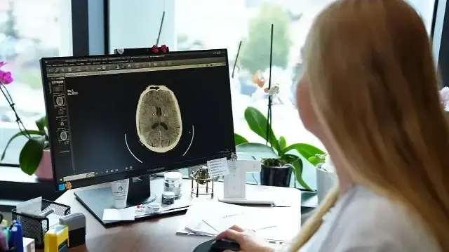 kume bas agrisi nedir belirtileri nelerdir uzmanindan onemli uyarilar ixXcMIsJ.webp